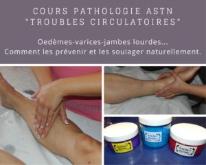 également embolie-migraine-infarctus...